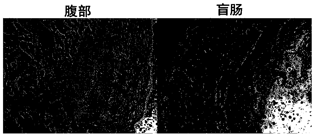 Novel hyaluronic acid flowing gel and preparation method and application thereof