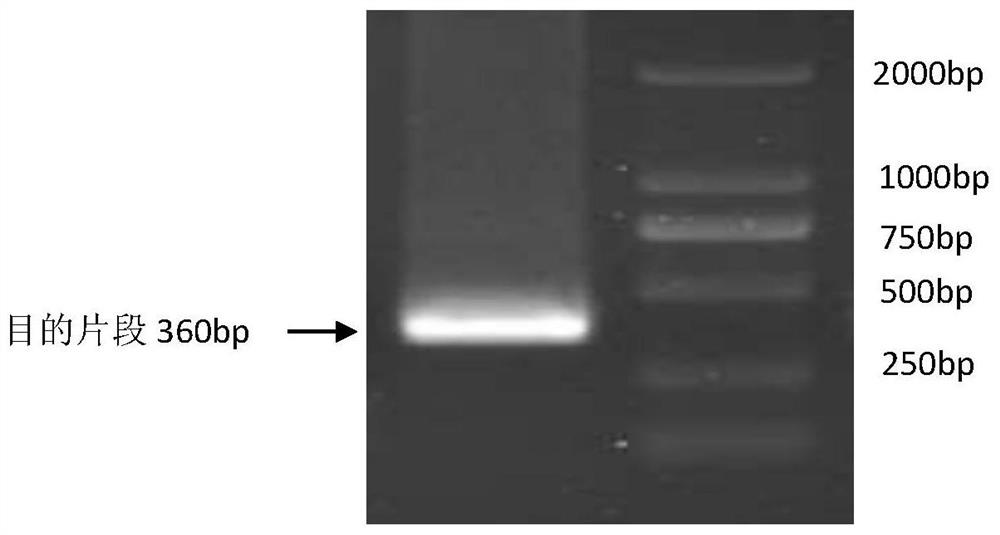 Application of disease-resistant gene Glyma.04G016500.1 of soybean