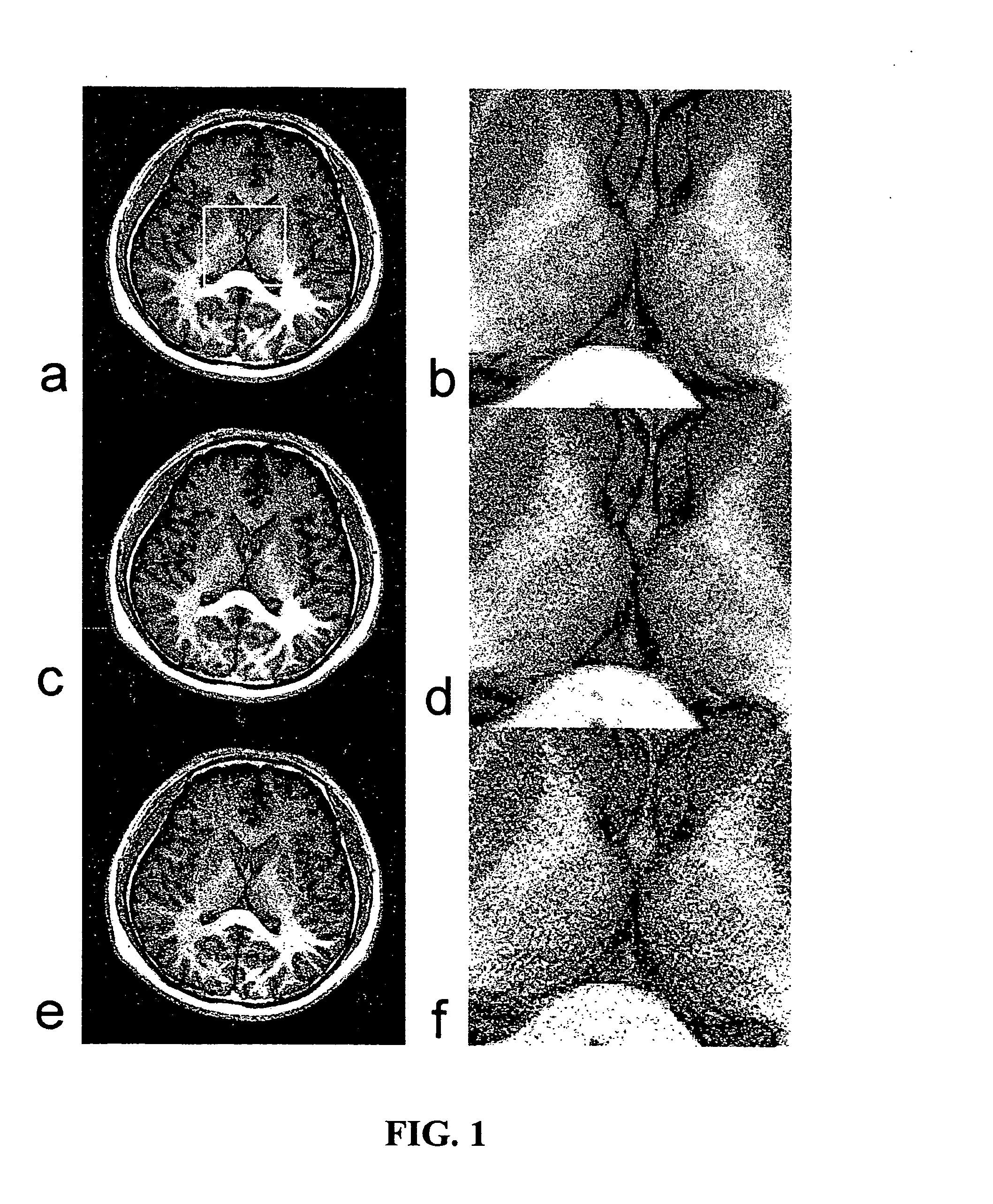 Method and Apparatus for Parameter Free Regularized Partially Parallel Imaging Using Magnetic Resonance Imaging