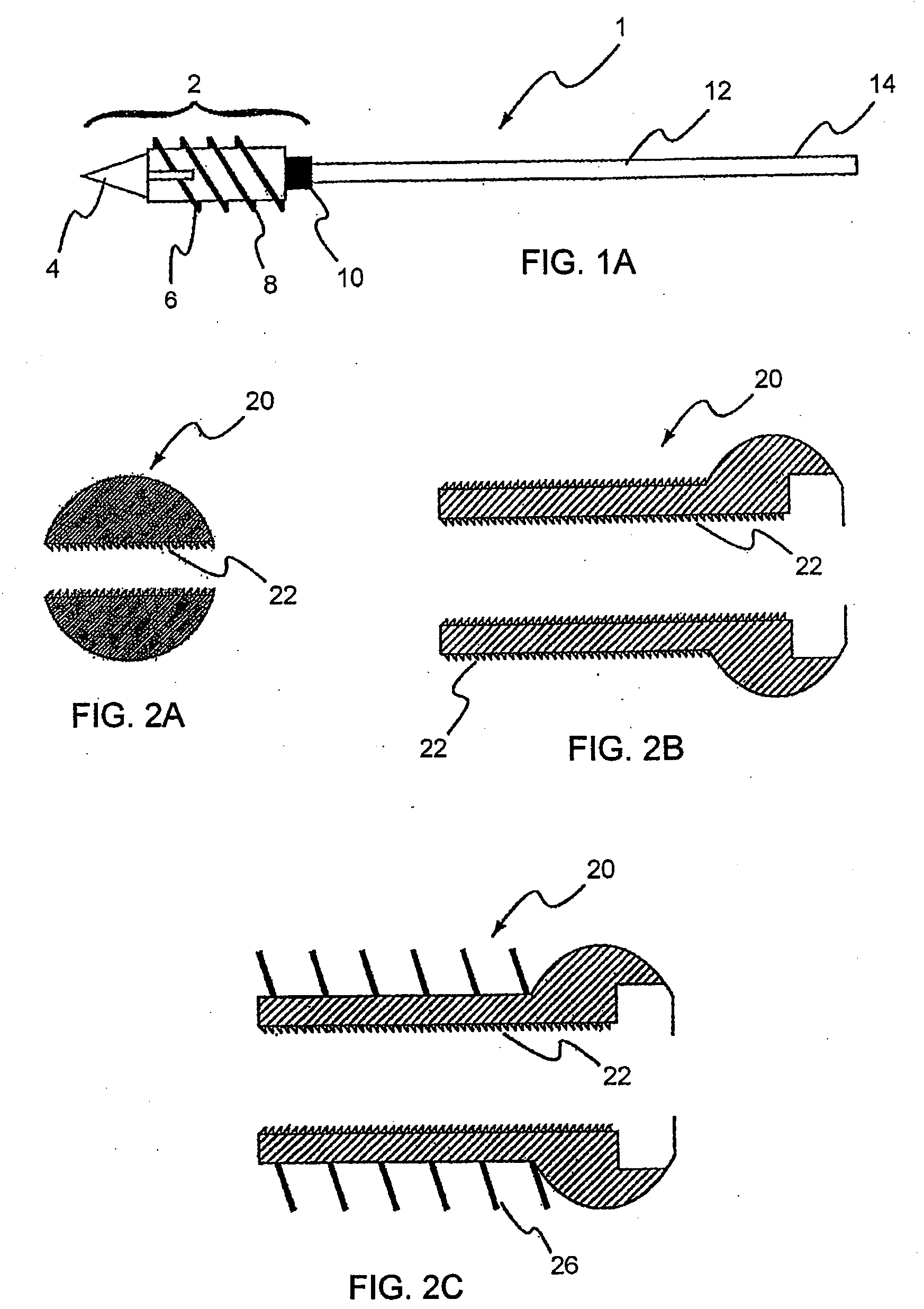 Bone screw system and method for the fixation of bone fractures