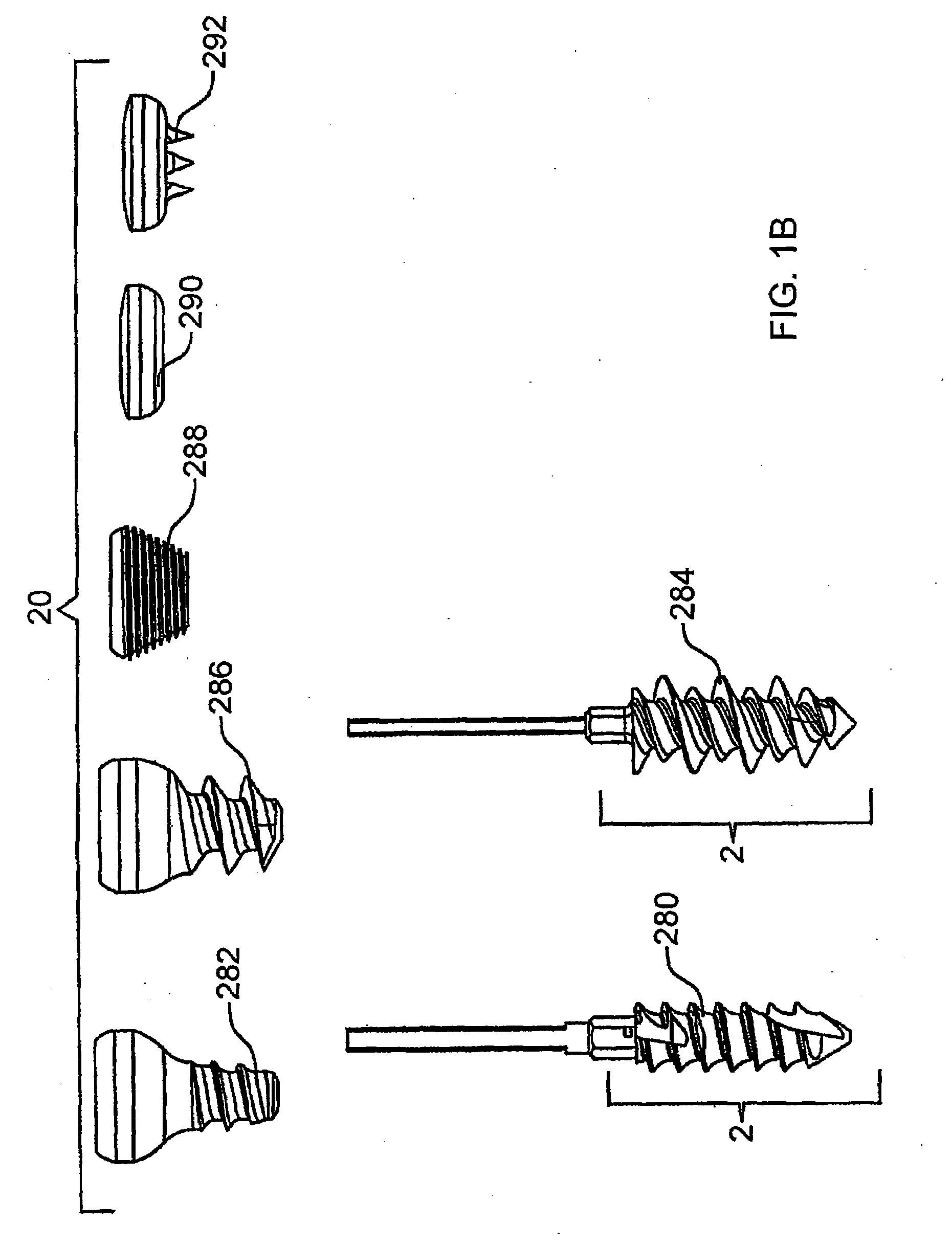 Bone screw system and method for the fixation of bone fractures