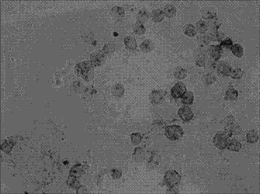 Kit and method for detecting horizontal in situ hybridization of MICRORNA-372 at the early pathological evolution stage of a variety of cancers and application thereof