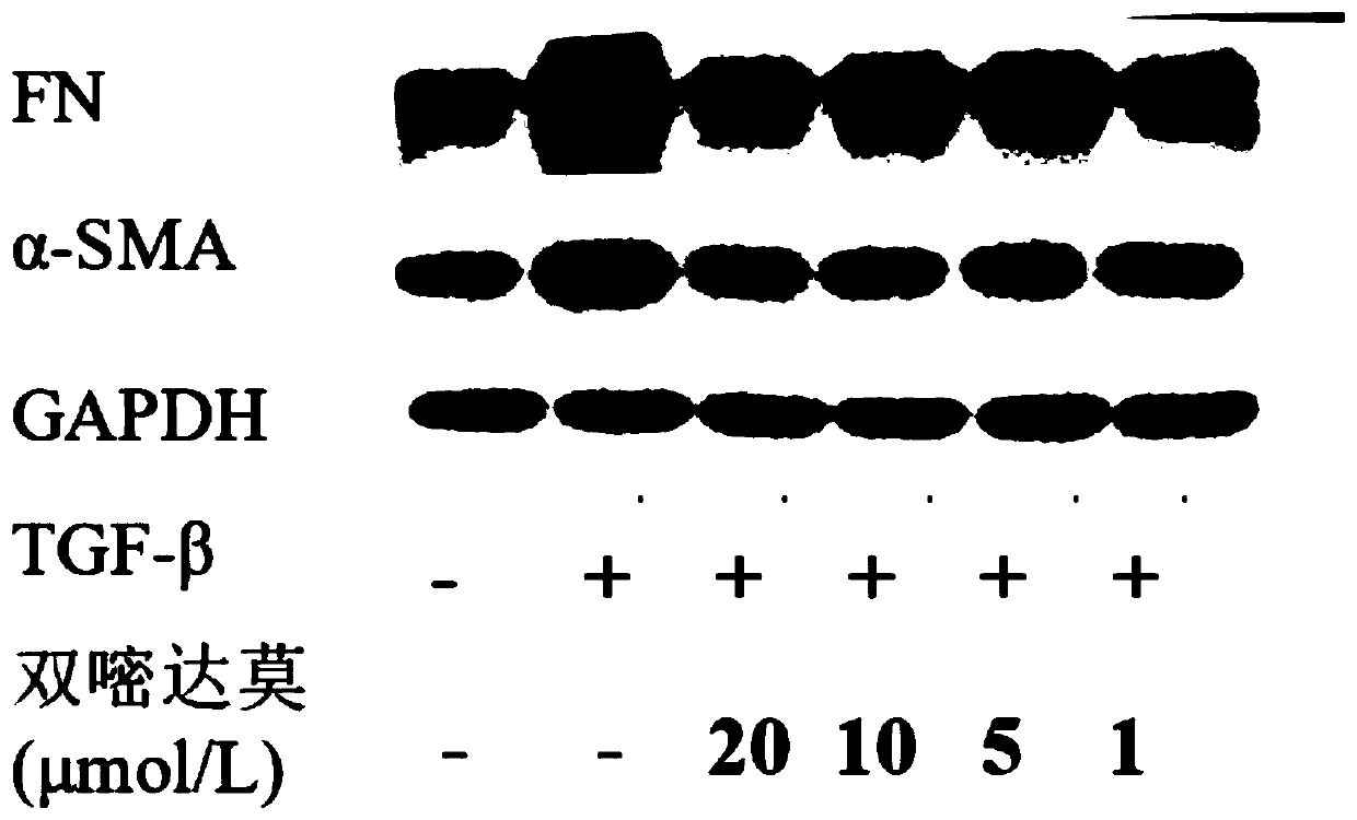 Application of dipyridamole or pharmaceutically acceptable salt thereof in preparation of medicine for preventing and/ or treating lung inflammation