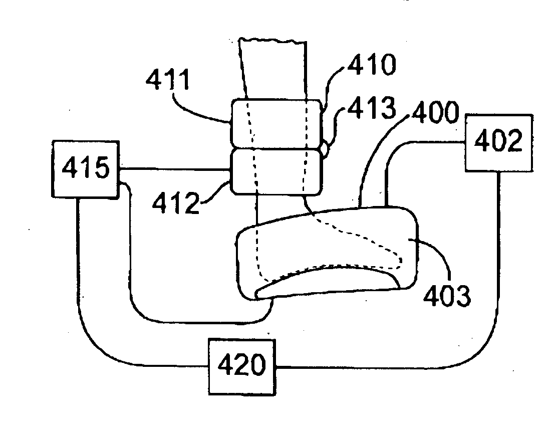 Heat transfer cuff