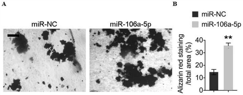 Application of miR-106a-5p simulant in preparation of bone defect repair medicine