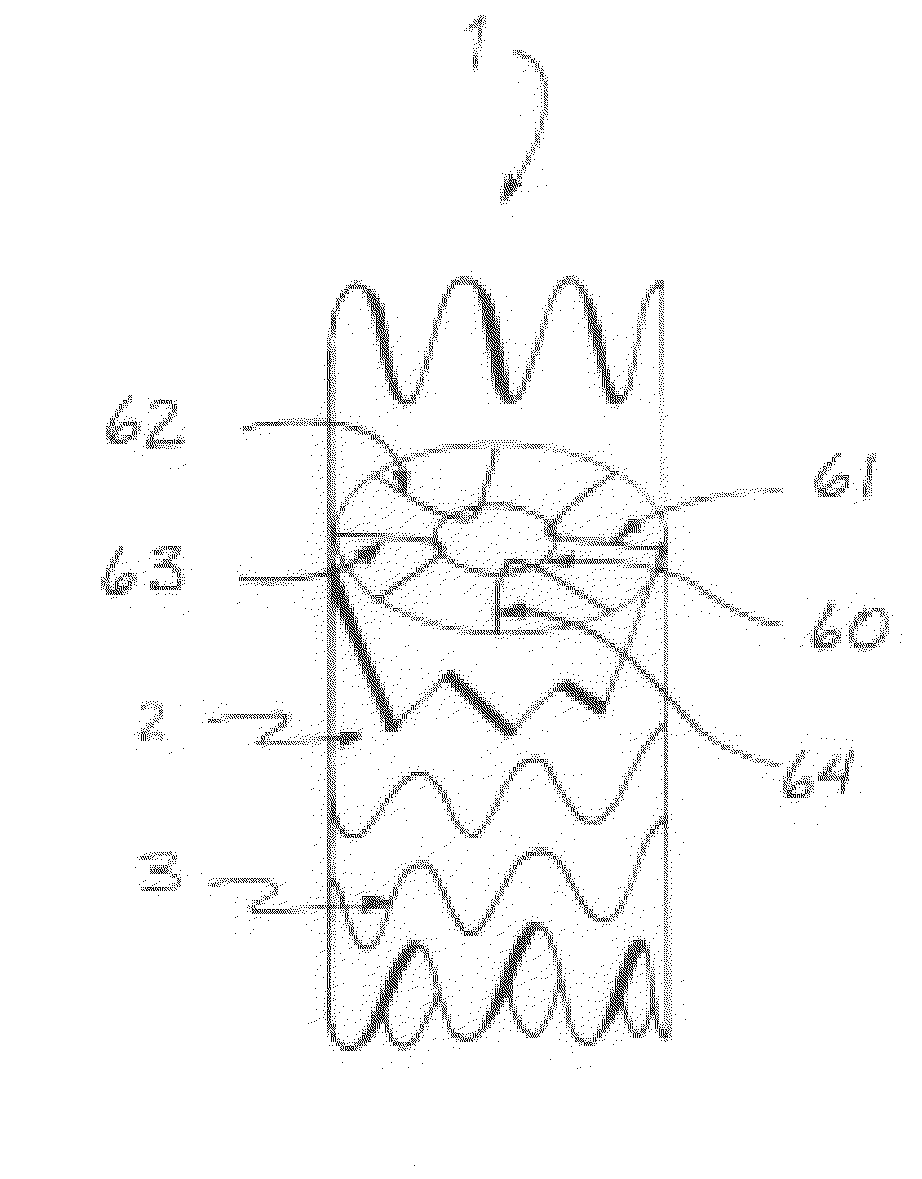 Absorbable Vascular Filter