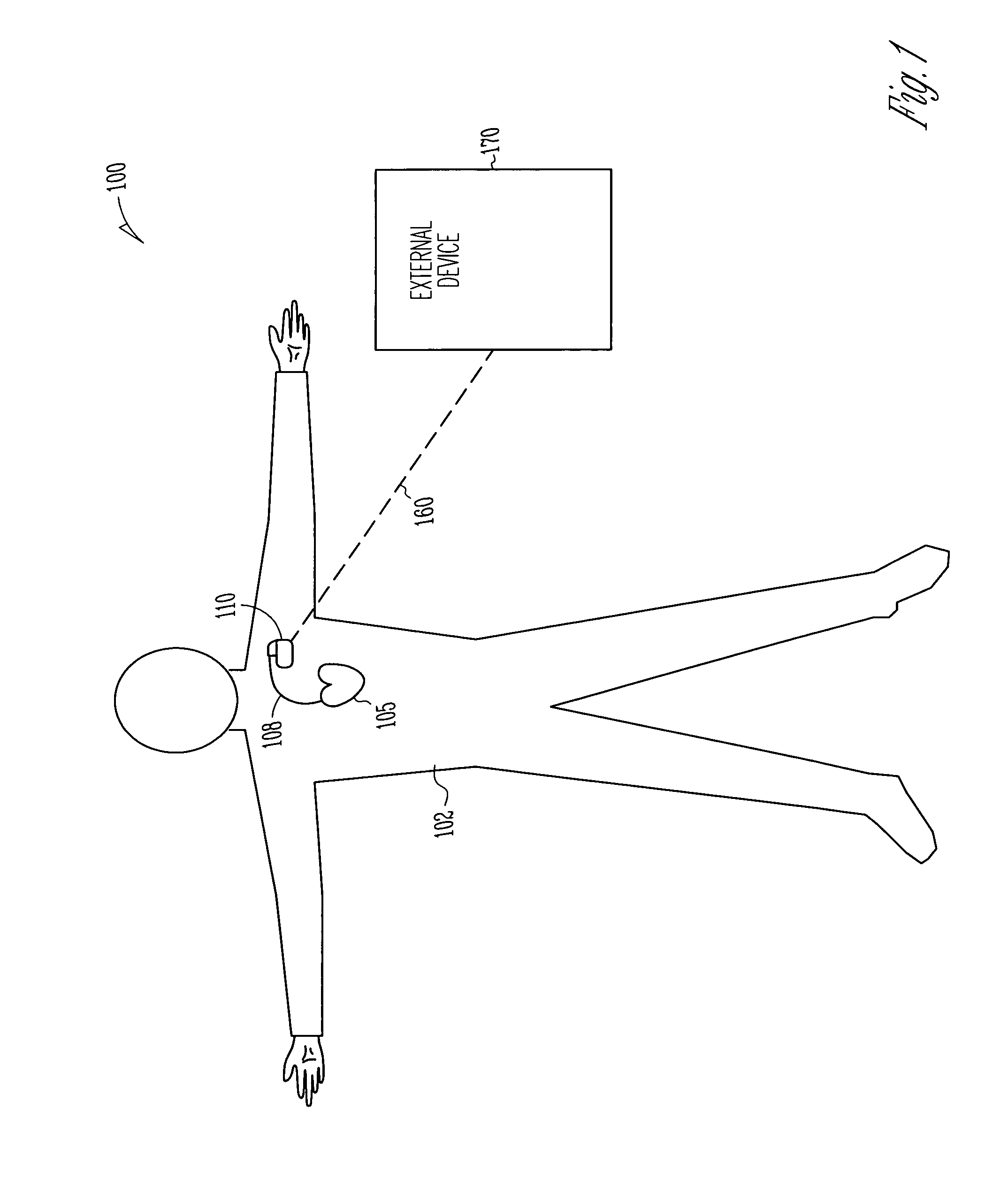 Intracardiac impedance and its applications