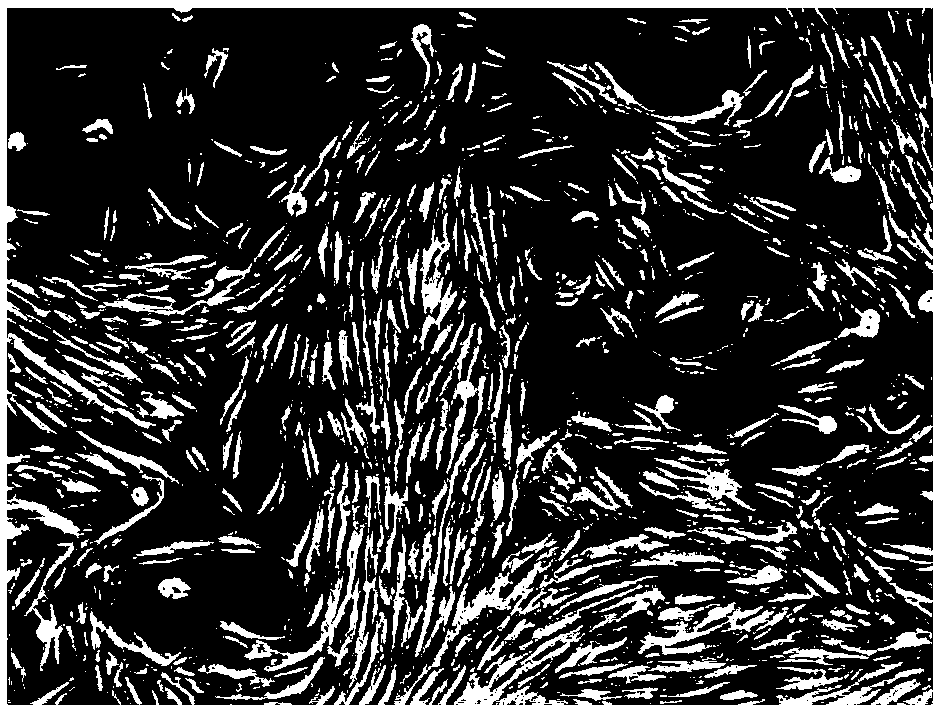 Application of tanespimycin to preparation of antibacterial and anti-inflammatory medicament