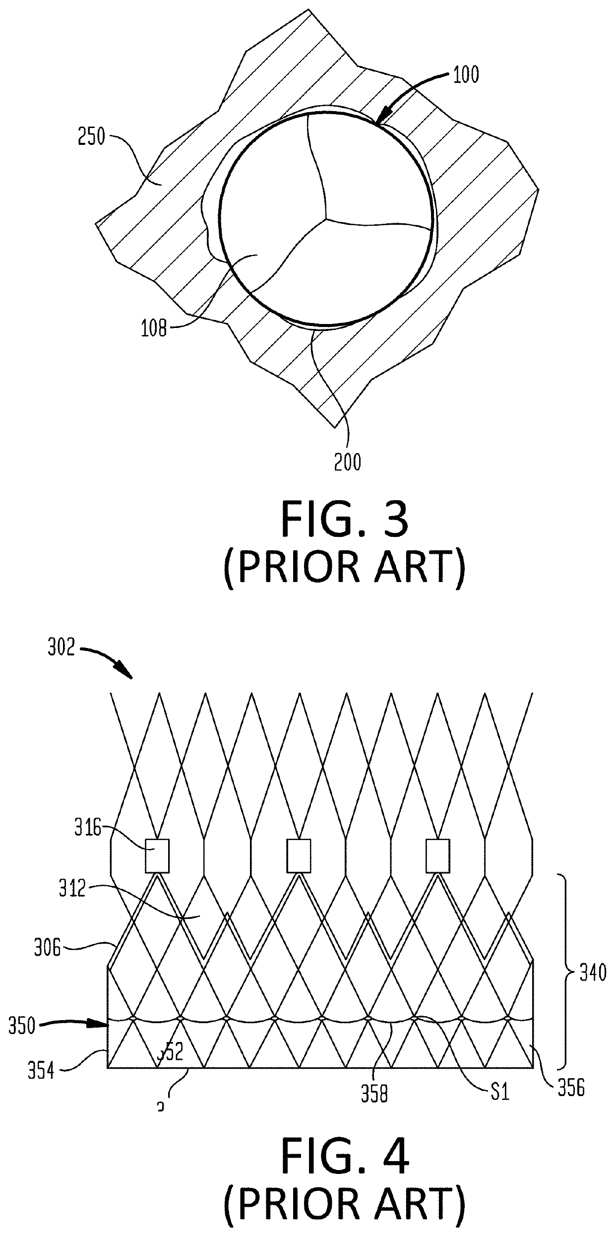 Fabric Material For Medical Devices