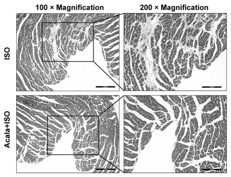 Pharmaceutical composition for inhibiting myocardial fibrosis