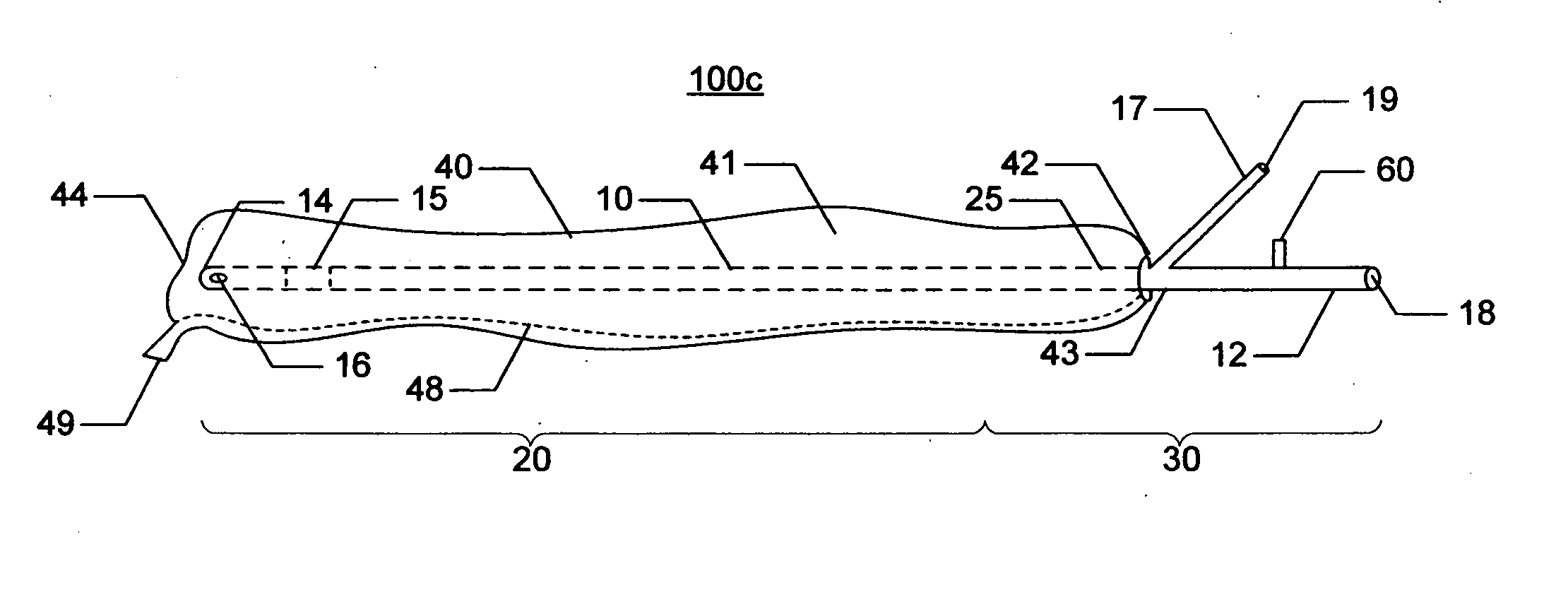 Indwelling urinary catheterization assembley