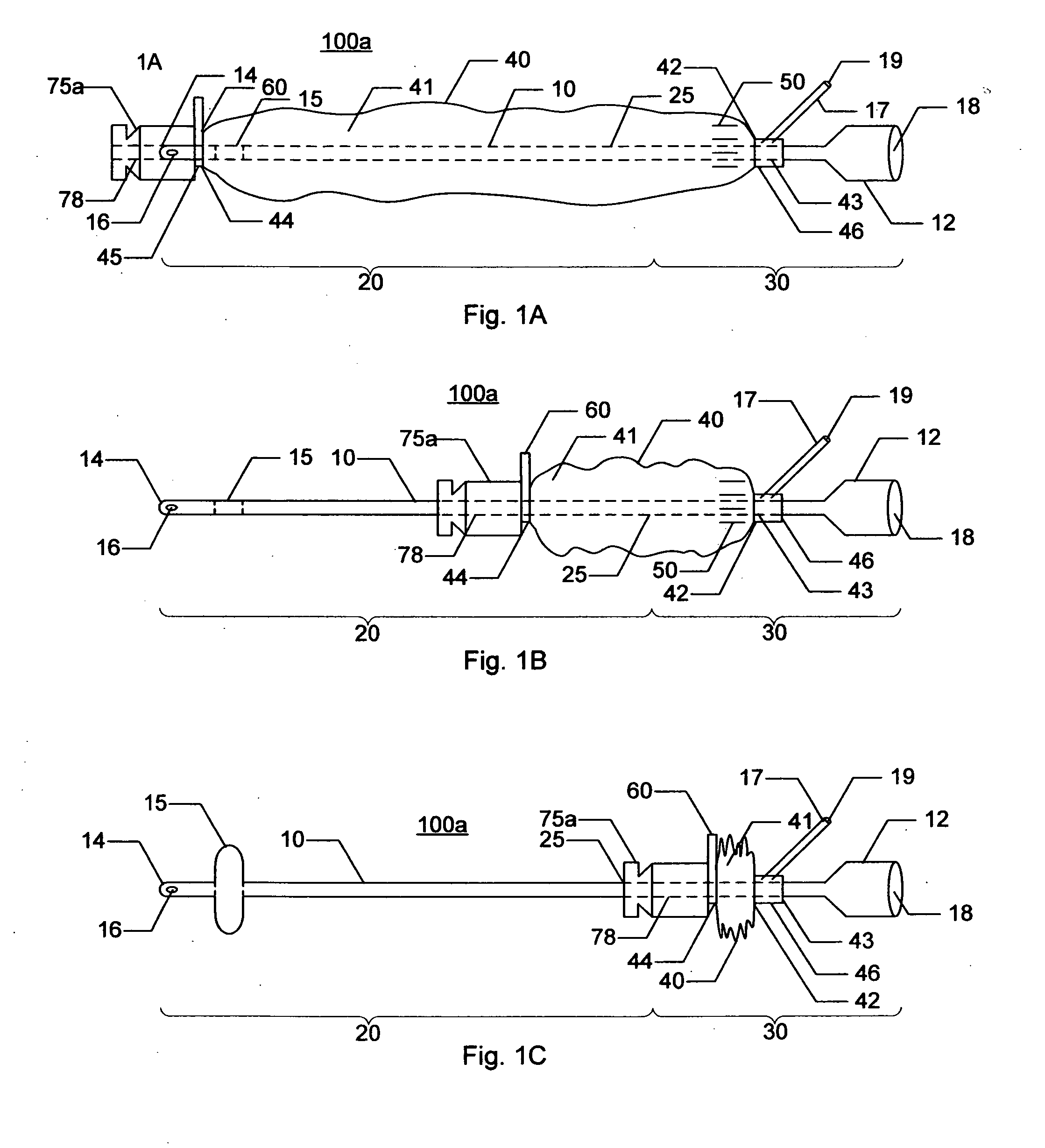 Indwelling urinary catheterization assembley