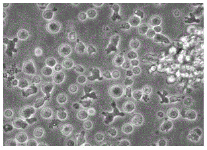 A kind of lak cell preservation solution and method for preparing and preserving lak cell