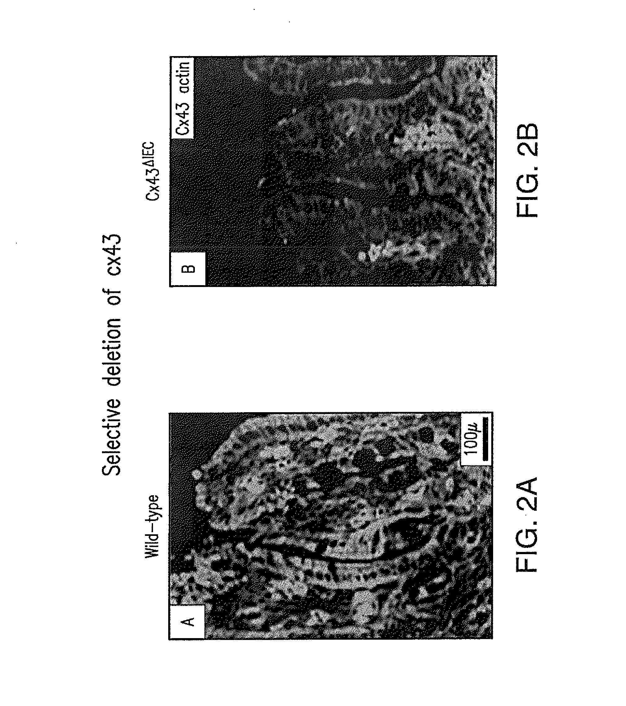 Gap Junction-Enhancing Agents for Treatment of Necrotizing Enterocolitis and Inflammatory Bowel Disease