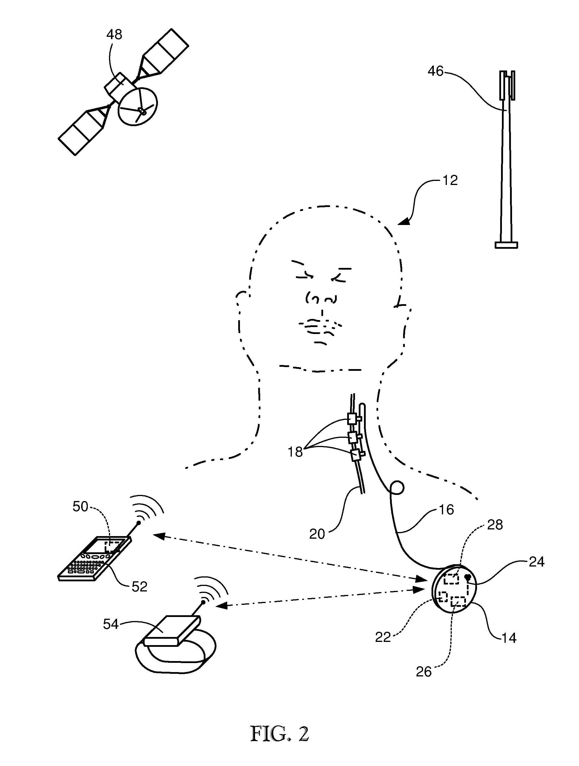 Battery life estimation based on voltage depletion rate