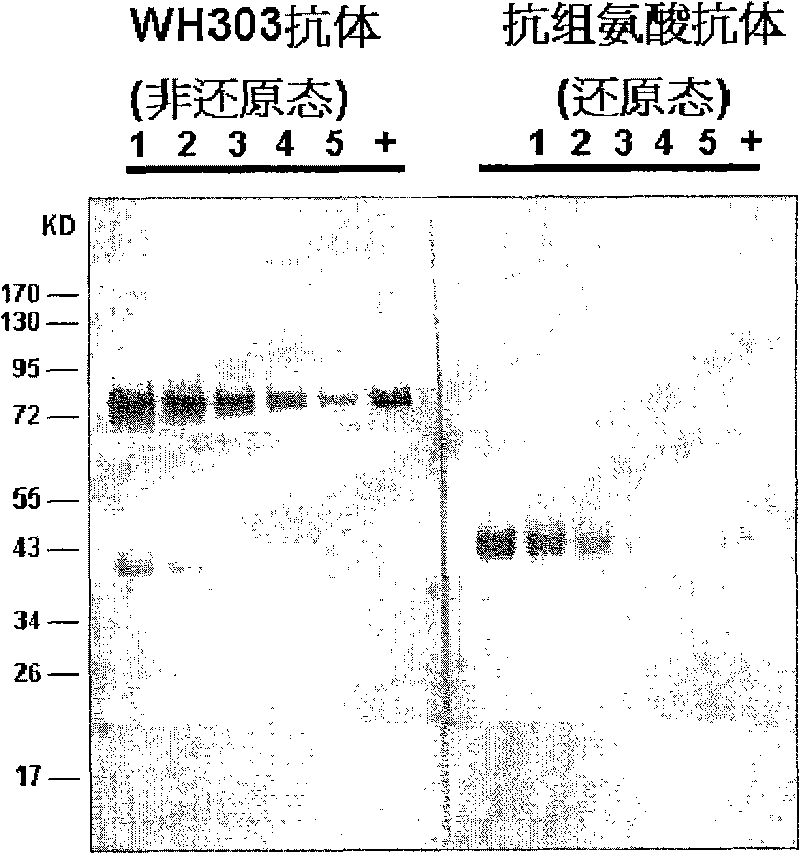 Classical swine fever virus E2 subunit vaccine and preparation thereof