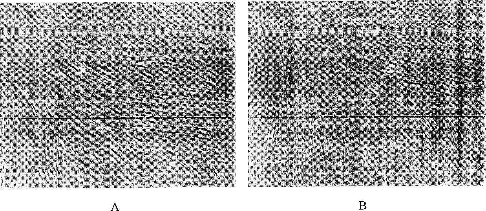 Monoclonal antibody ZUB1 of human bone marrow mesenchymal stem cells and application thereof