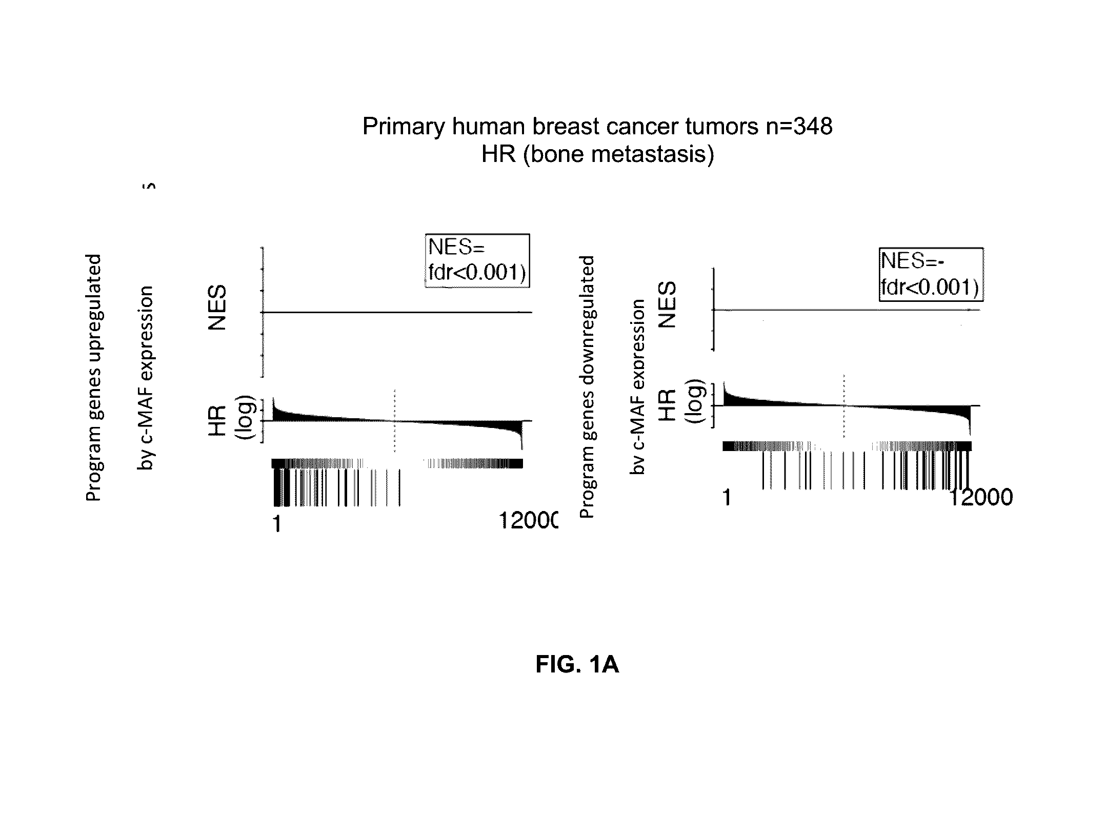 Method for the diagnosis, prognosis and treatment of cancer metastasis