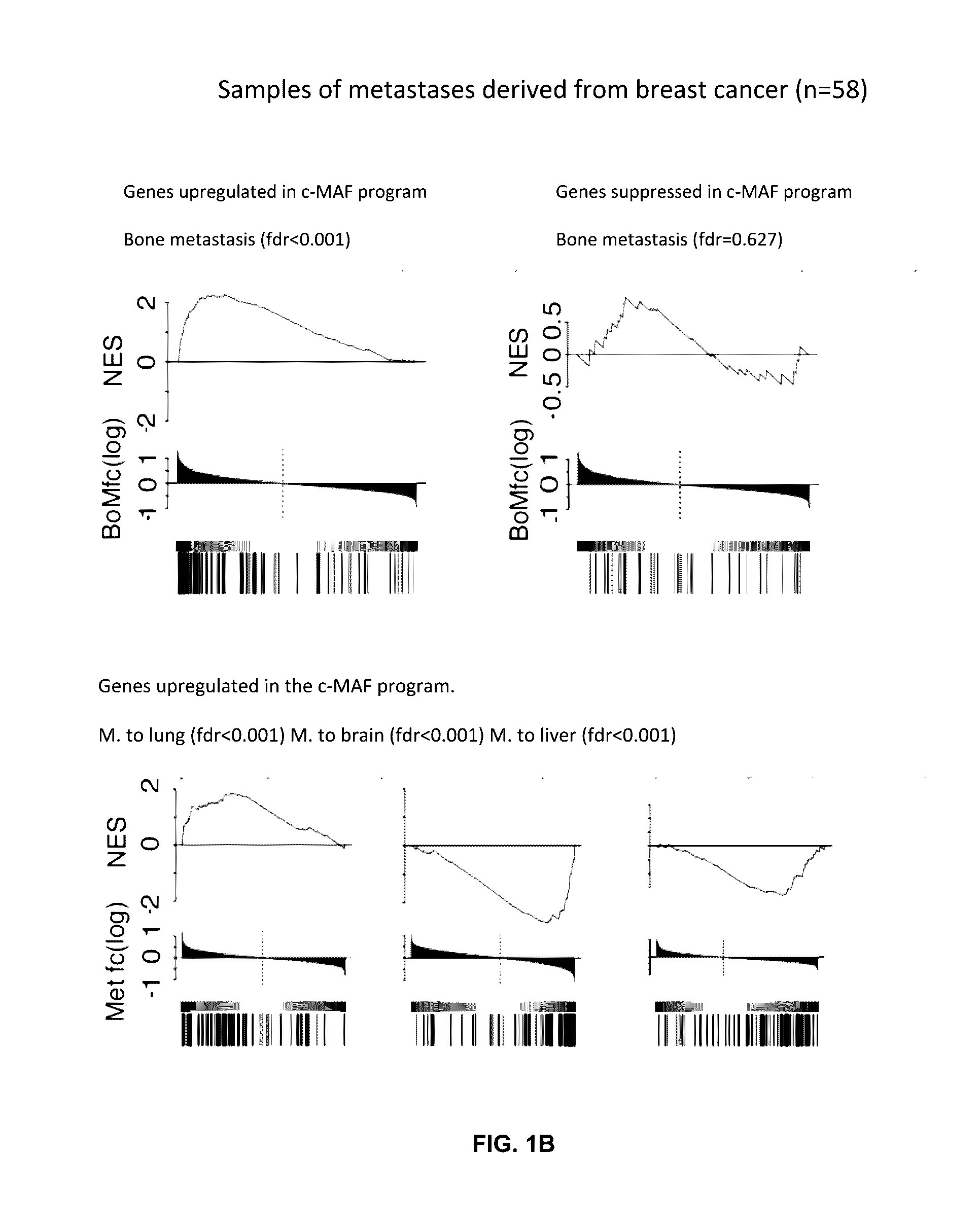 Method for the diagnosis, prognosis and treatment of cancer metastasis