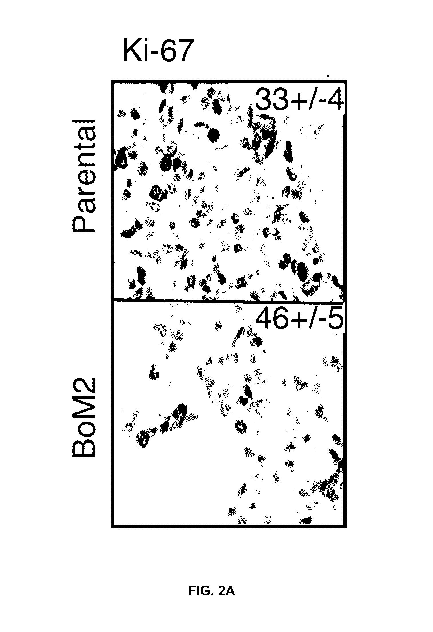 Method for the diagnosis, prognosis and treatment of cancer metastasis