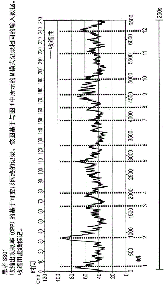 Method and system for diagnosing uterine contraction levels using image analysis