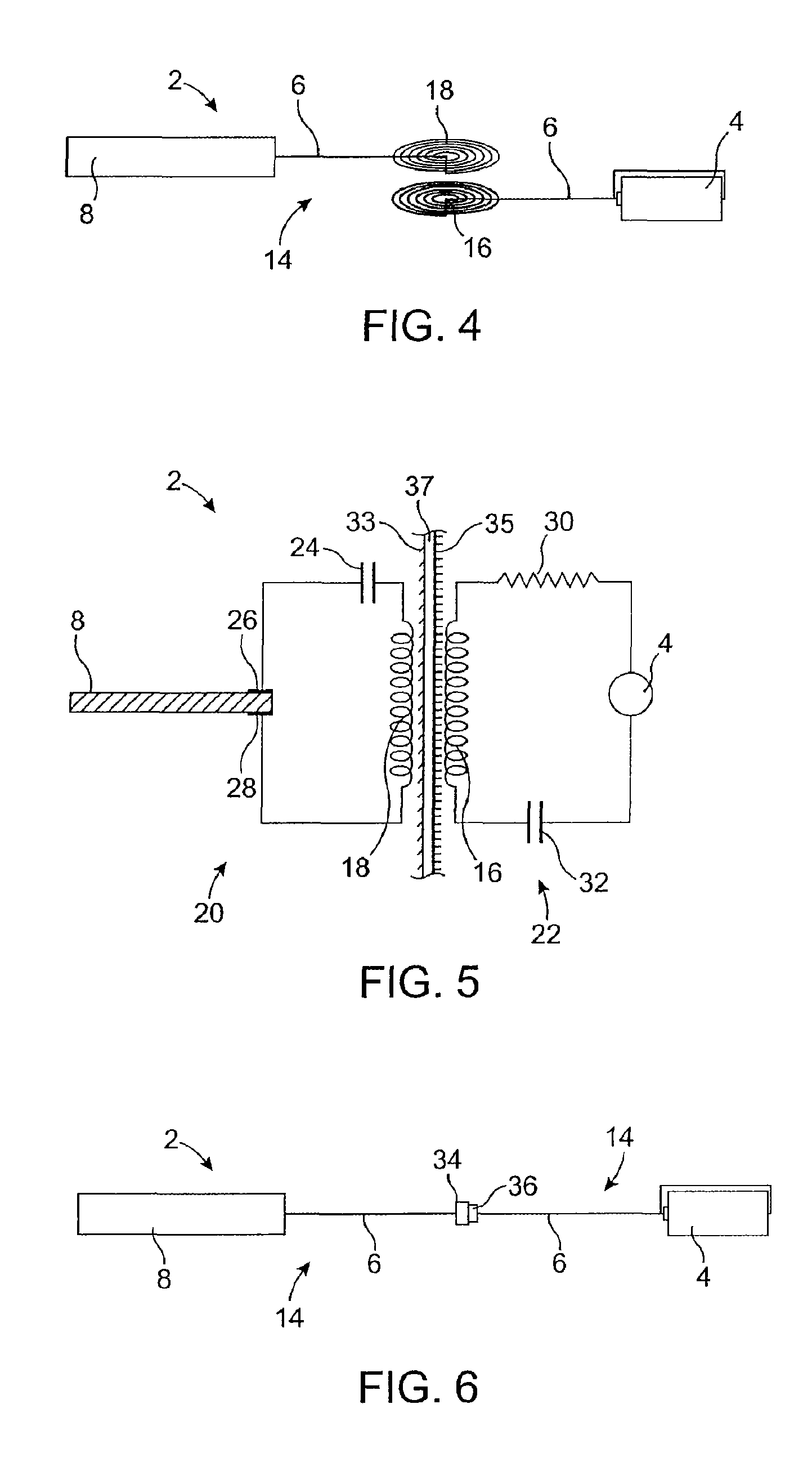 Implantable obstructive sleep apnea sensor