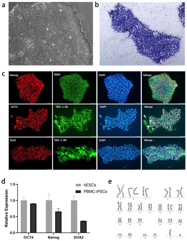 Method for preparing liver organoid from peripheral blood mononuclear cells