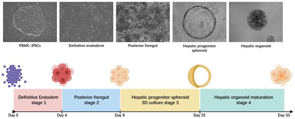 Method for preparing liver organoid from peripheral blood mononuclear cells