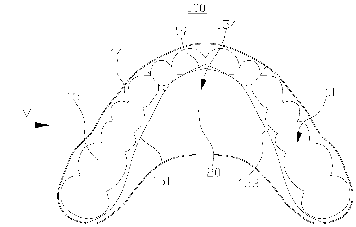 Maxillary expansion tooth socket and processing method