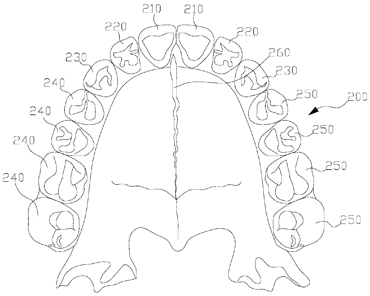 Maxillary expansion tooth socket and processing method