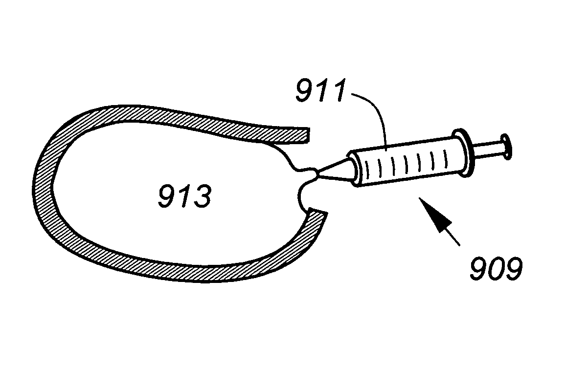 Artificial intervertebral disc replacements incorporating reinforced wall sections