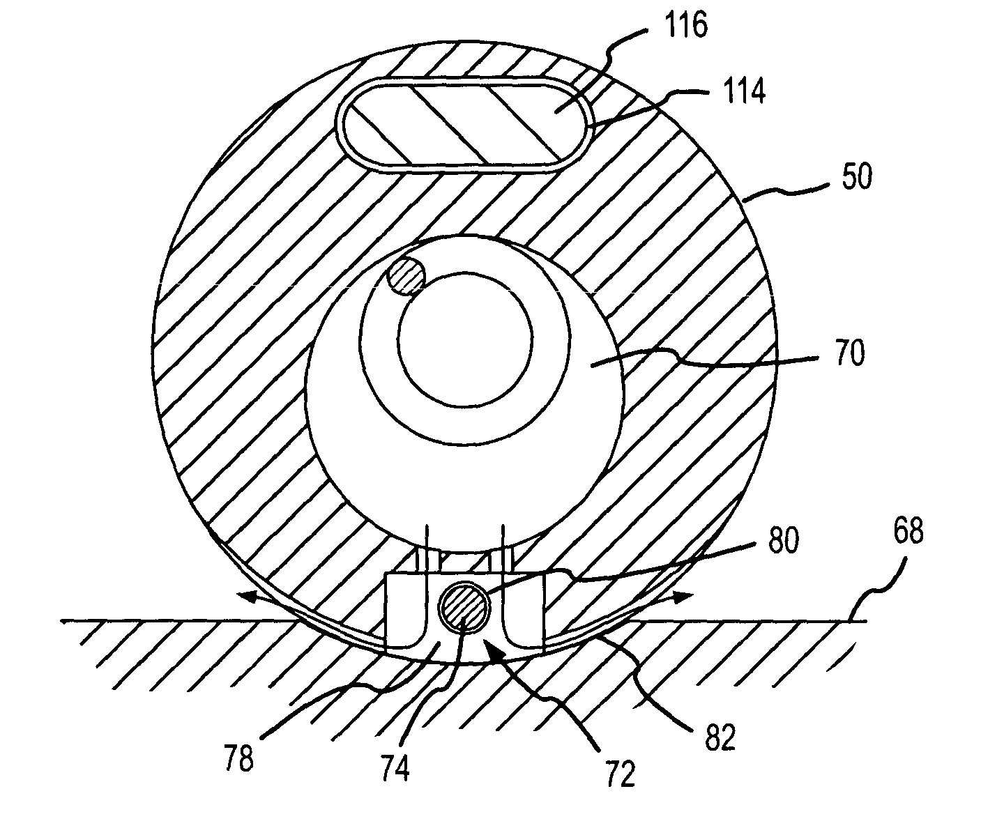 Ablation catheter electrode arrangement