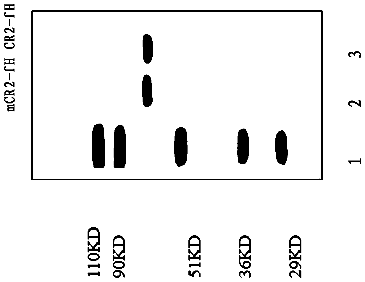 Human targeting complement inhibitor protein mCR2-fH and application