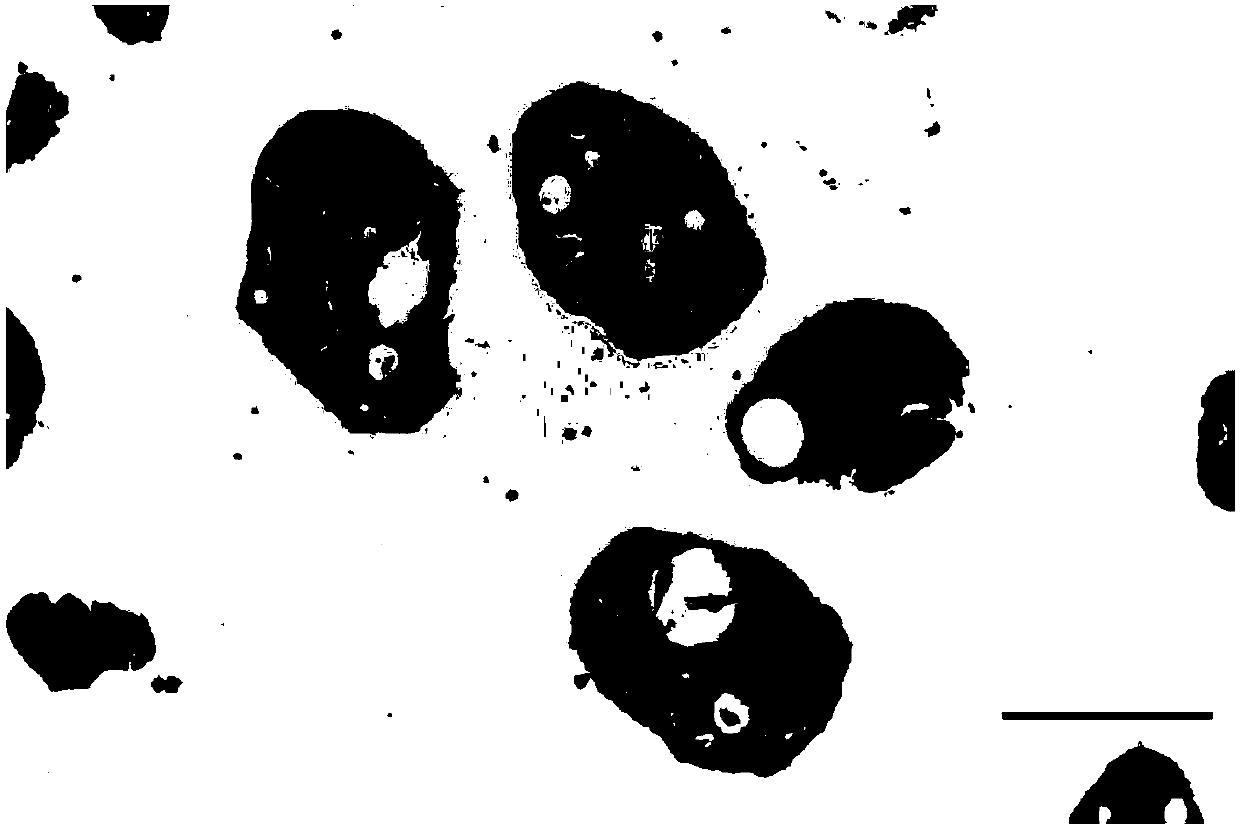 Colorectal cancer solid tumor tissue sample preserving fluid