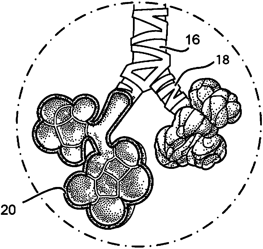 Methods and devices for the treatment of pulmonary disorders