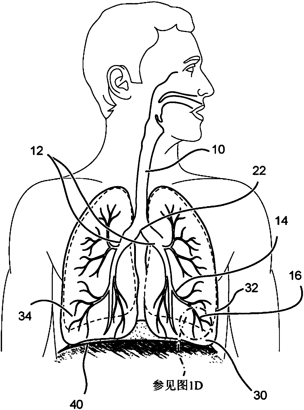 Methods and devices for the treatment of pulmonary disorders