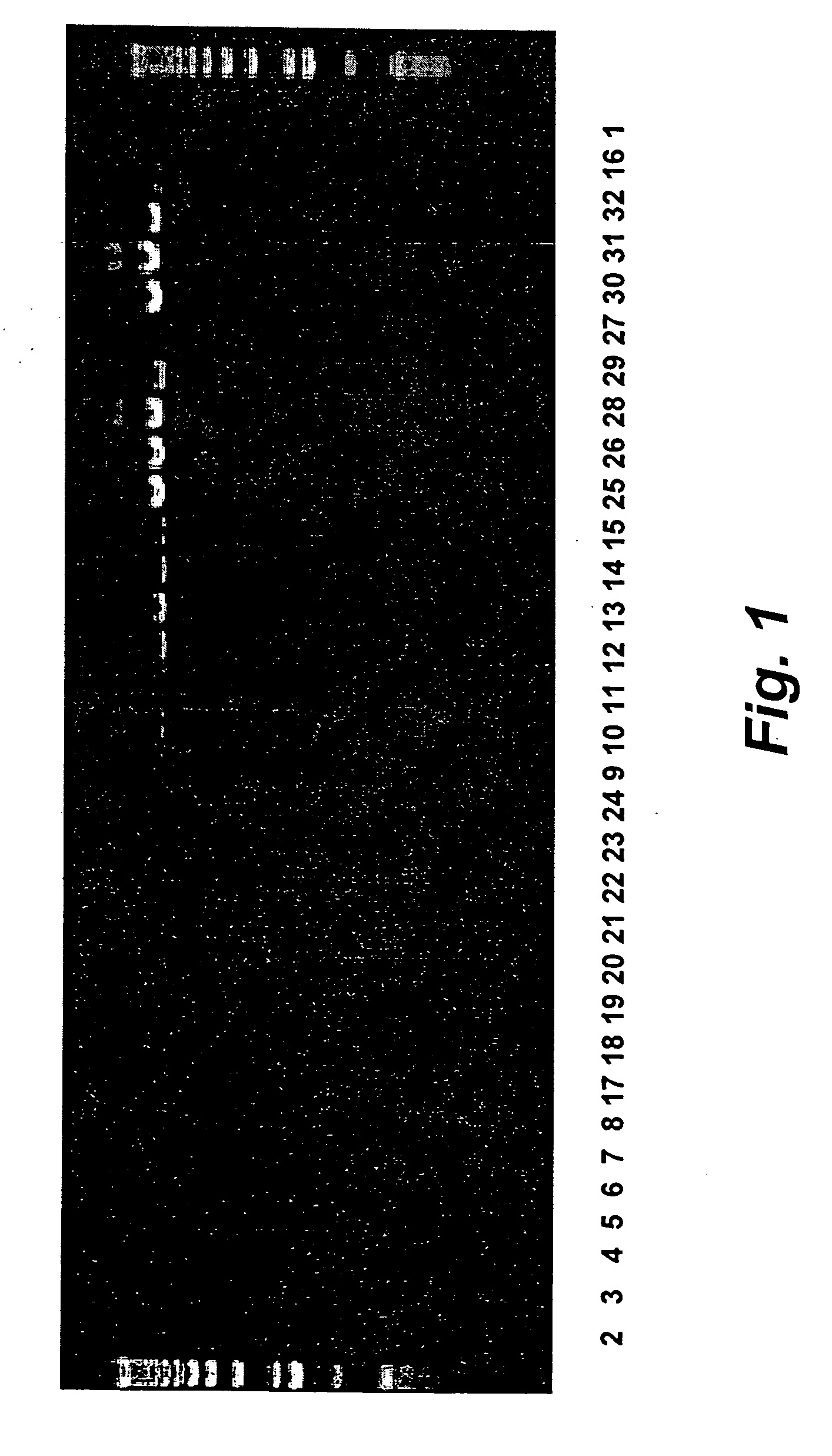 Transgenic avians containing recombinant ovomucoid promoters