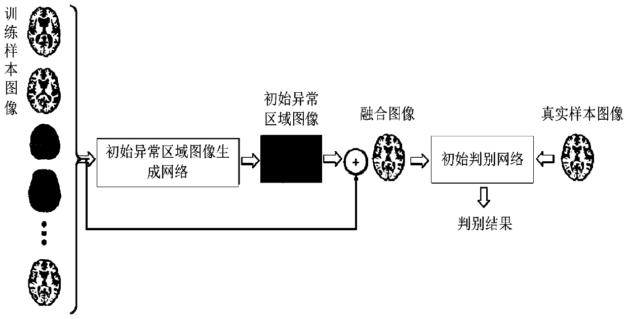 Training method of abnormal region image generation network and related products