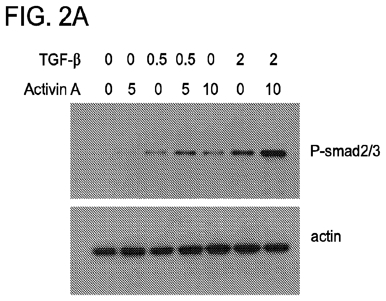 Compositions and methods for targeting activin signaling to treat cancer