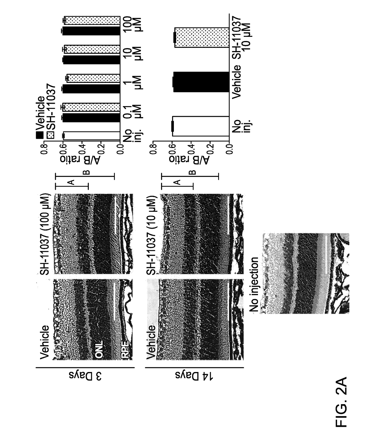 Composition for blocking angiogenesis