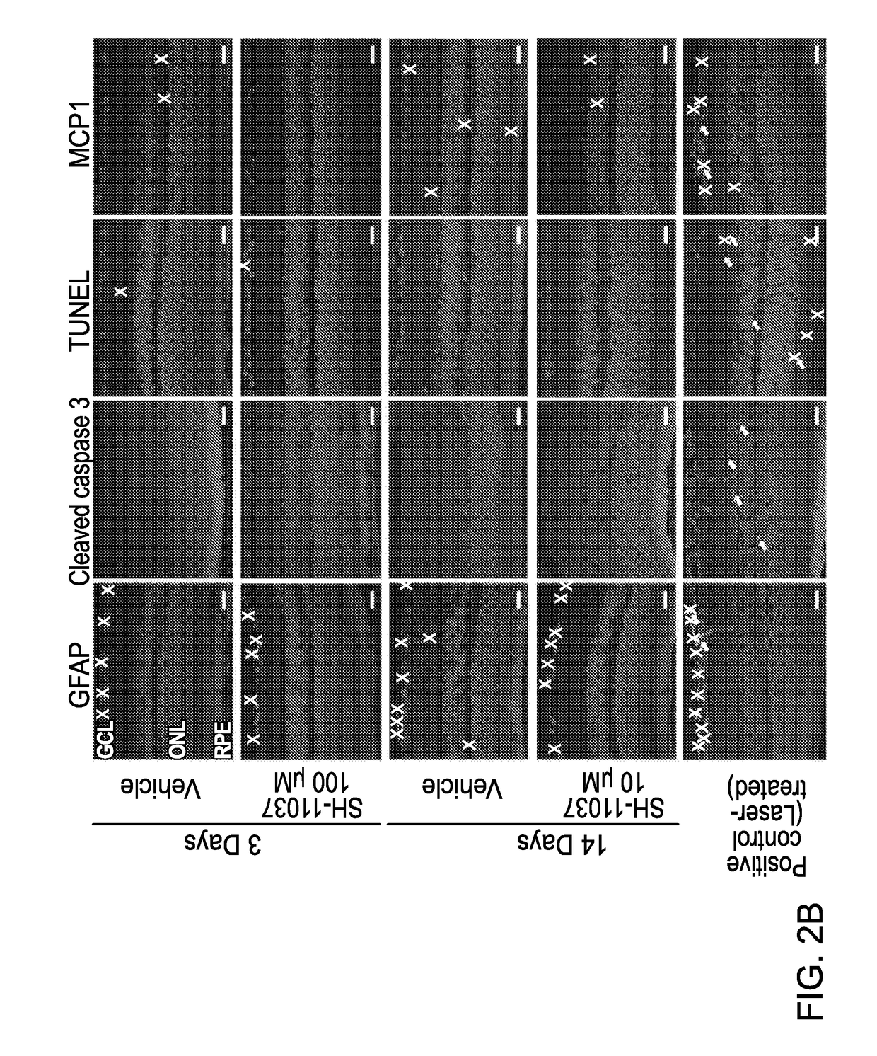 Composition for blocking angiogenesis