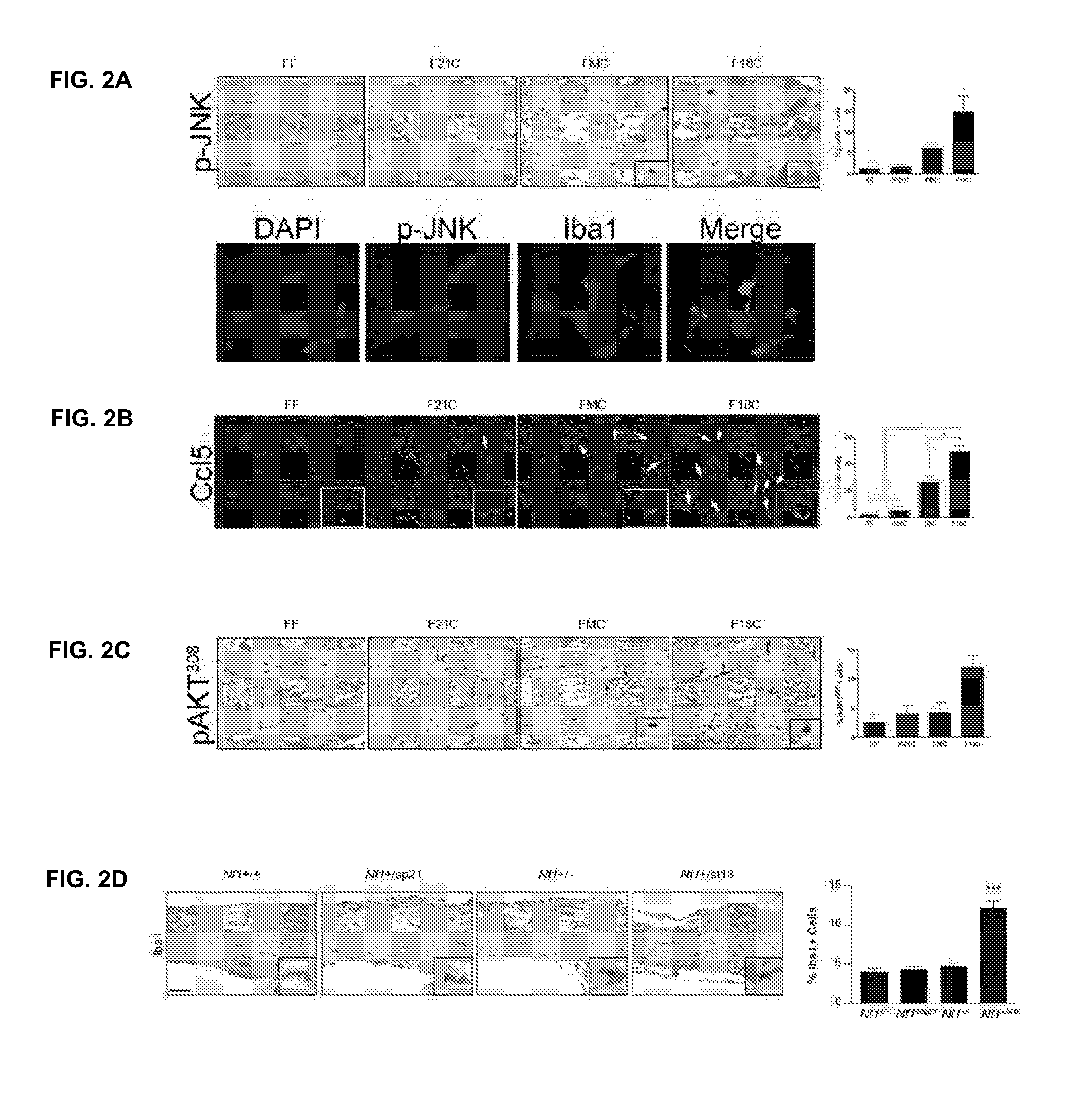 Neurofibromin/dopamine signaling as a biomarker for cognitive and behavioral problems in children with neurofibromatosis type 1 (NF1)