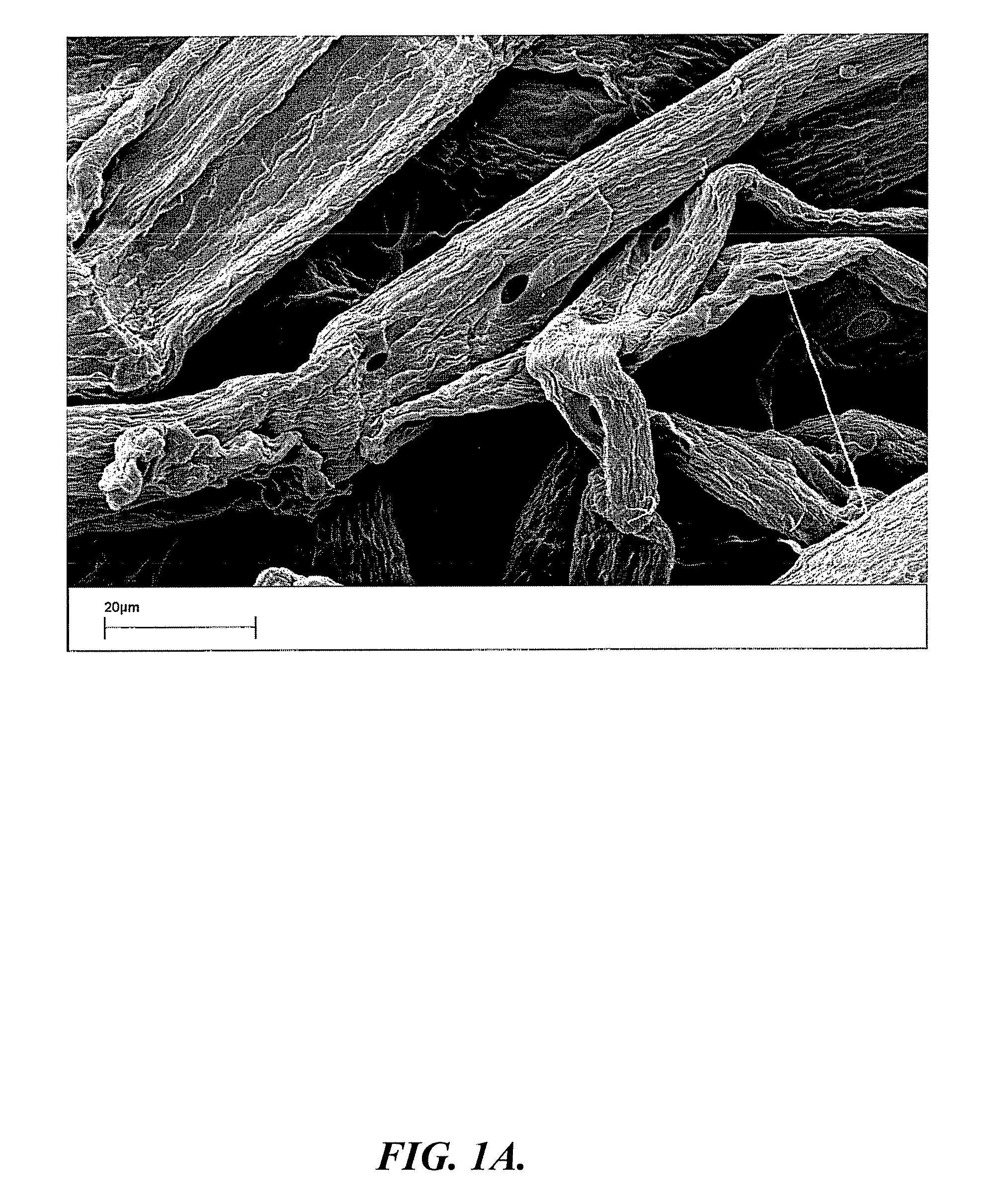 Crosslinked carboxyalkyl cellulose fibers having permanent and non-permanent crosslinks