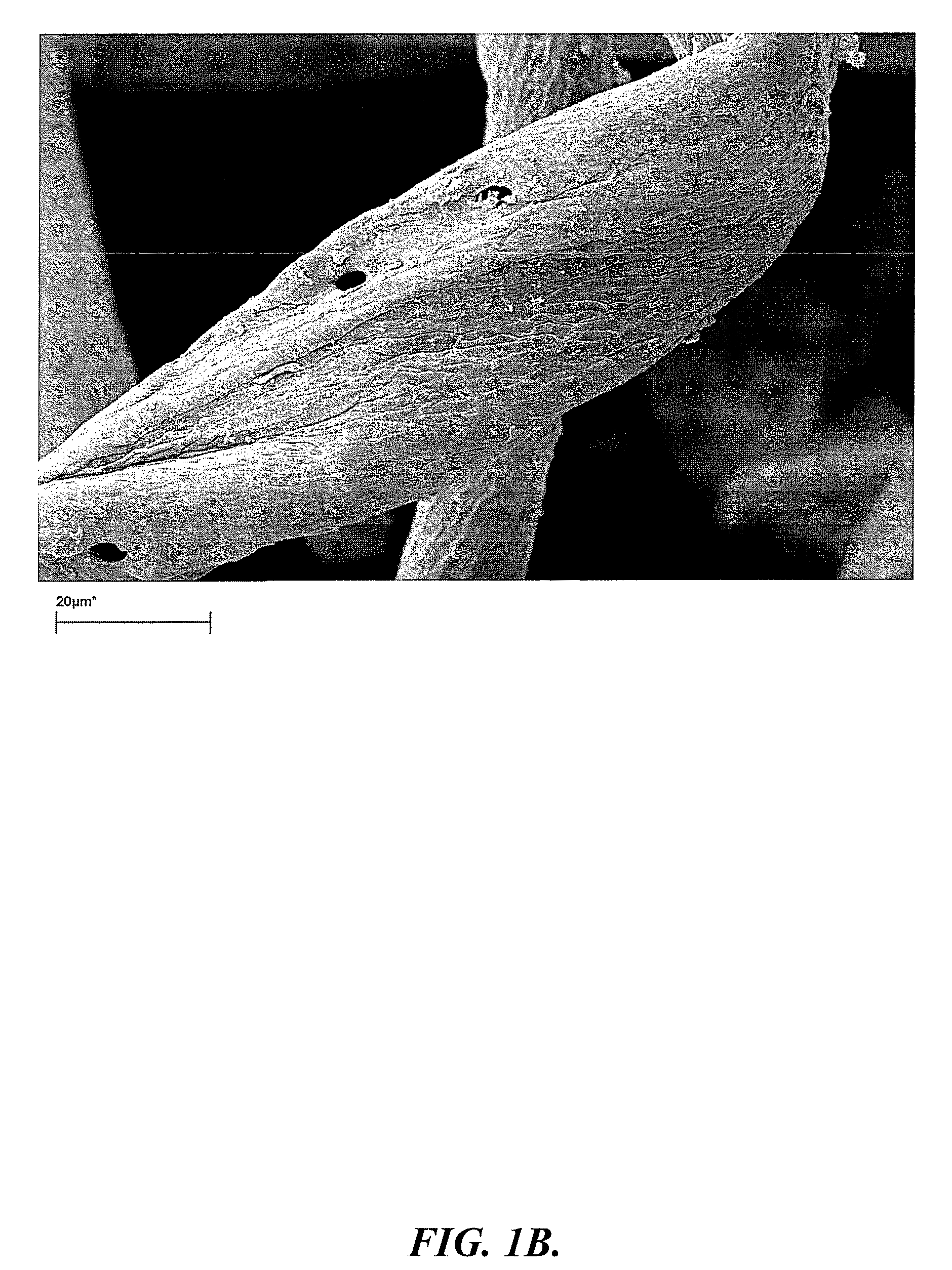 Crosslinked carboxyalkyl cellulose fibers having permanent and non-permanent crosslinks