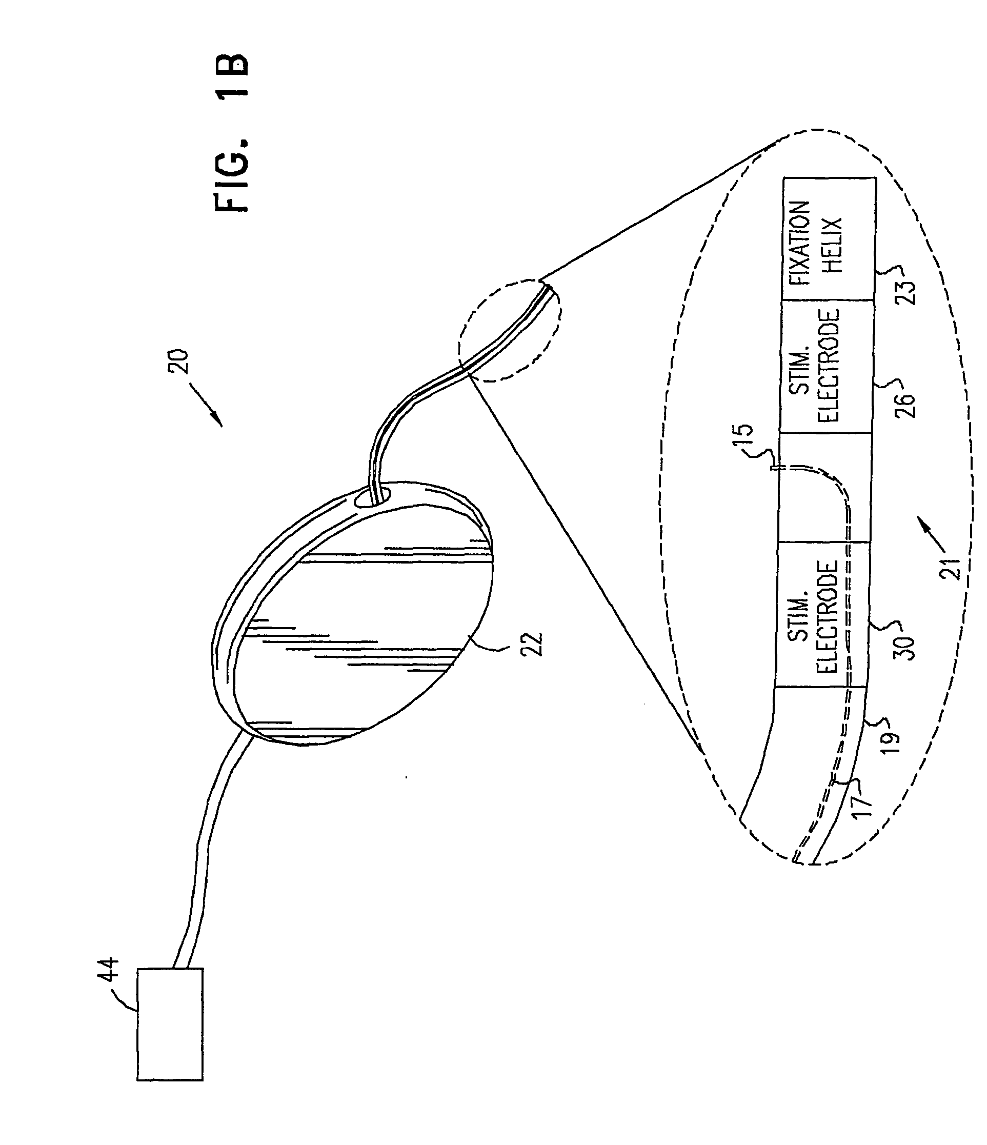 Pelvic disorder treatment device