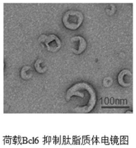 Immunoregulation microsphere preparation targeting tumor-associated macrophages (TAMs) as well as preparation method and application of immunoregulation microsphere preparation