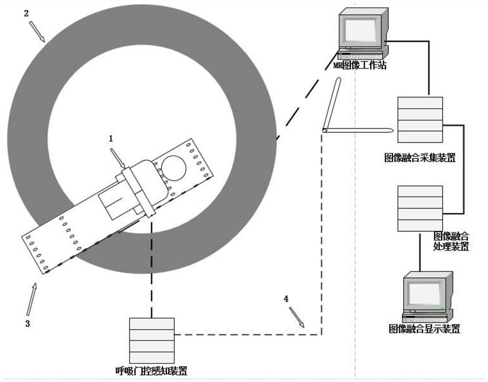 An image guidance device for respiratory gating and nuclear magnetic resonance image fusion