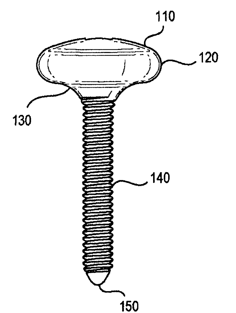 System and methods of maintaining space for augmentation of the alveolar ridge