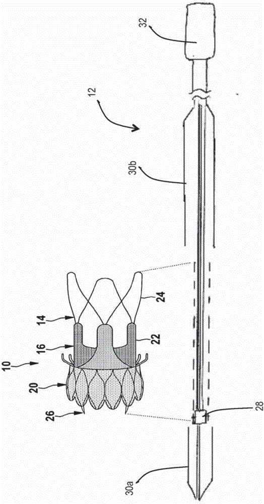 Method and apparatus for compressing/loading stent-valves