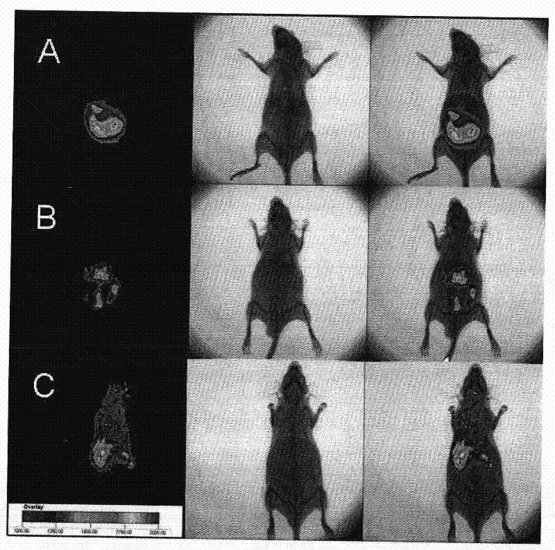 A brain-targeted drug delivery system